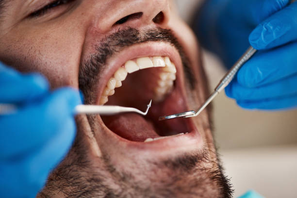 Best Emergency Dental Care for Broken or Chipped Teeth in Manchester, PA